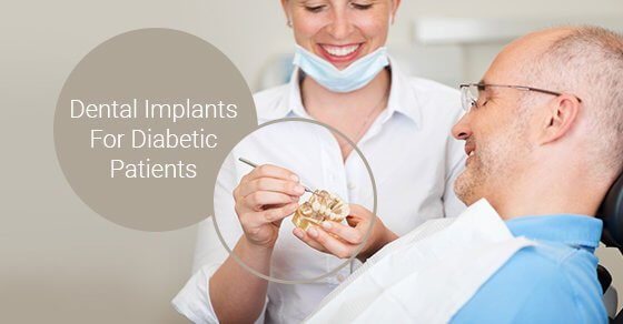 dental implants for diabetic patient
