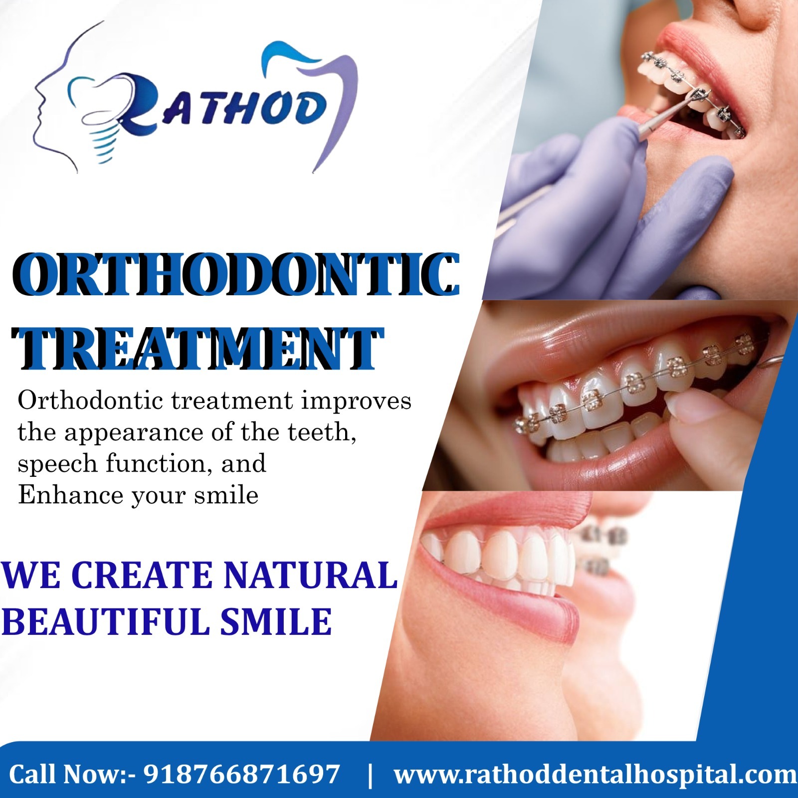 Transform Your Smile with Confidence at Rathod Dental