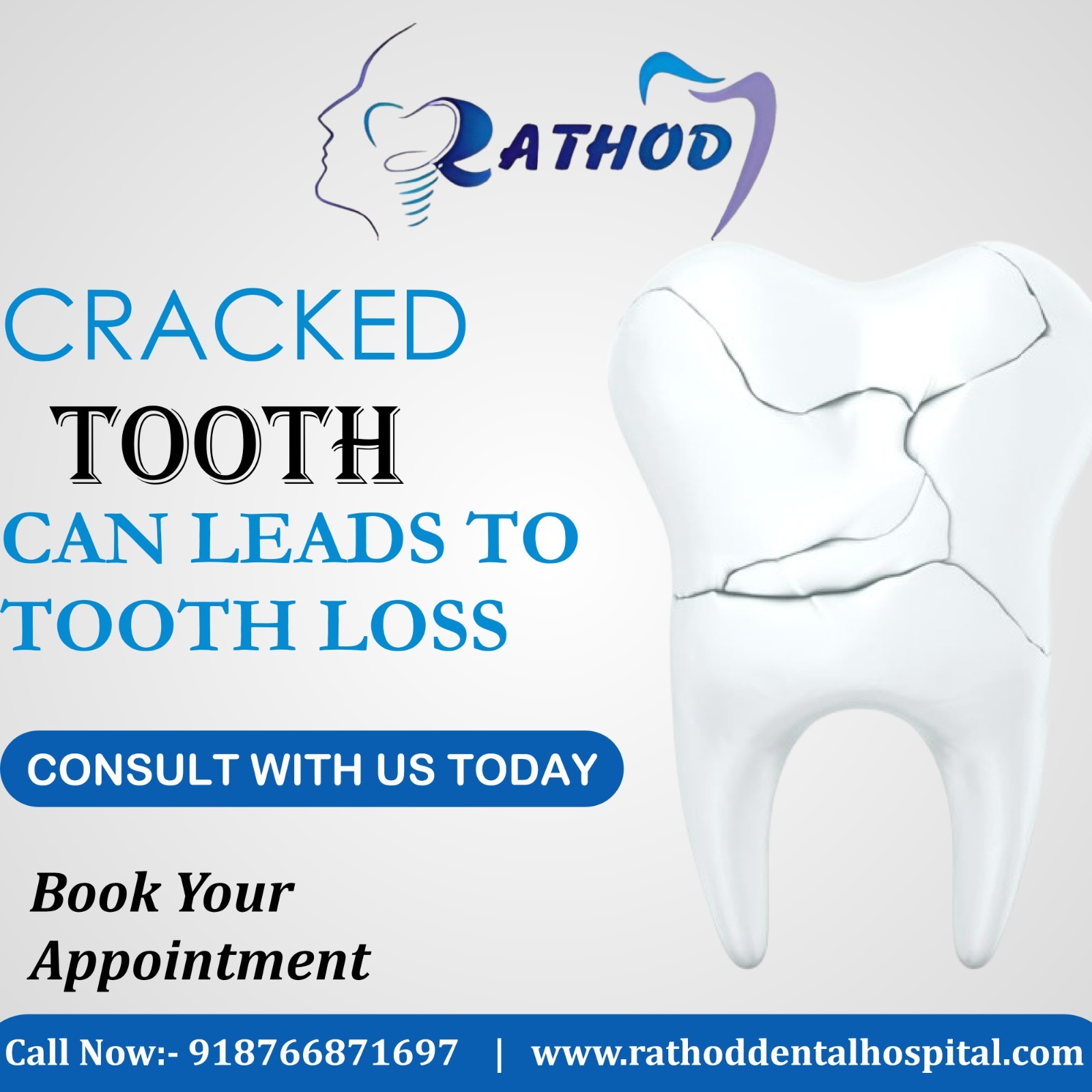  A Cracked Tooth Can Lead to Tooth Loss – Don’t Ignore the Warning Signs! 